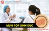 Mụn rộp sinh dục là gì? Có nguy hiểm không?