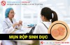 Mụn rộp sinh dục là gì? Có nguy hiểm không?